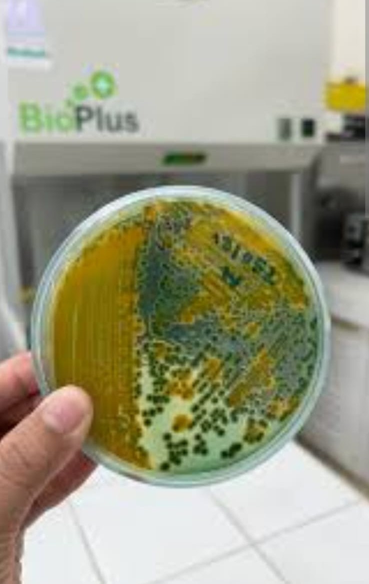 Pathogen Screening